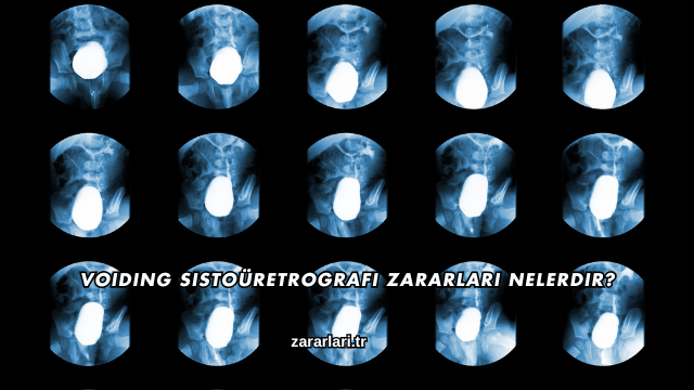 Voiding Sistoüretrografi Zararları Nelerdir?
