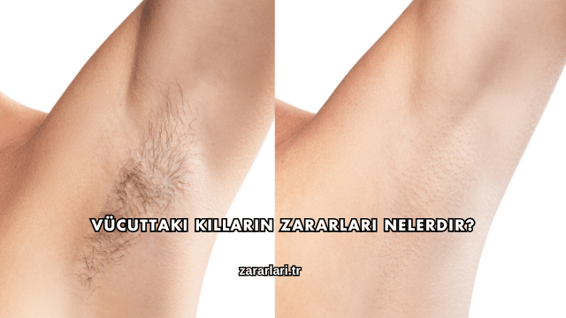 Vücuttaki Kılların Zararları Nelerdir?