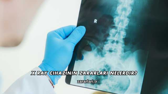 X Ray Cihazının Zararları Nelerdir?