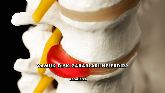 Yamuk Disk Zararları Nelerdir?