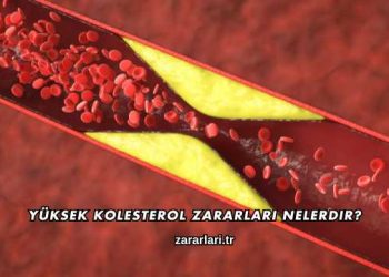Yüksek Kolesterol Zararları Nelerdir?